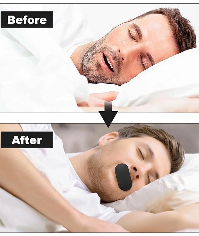 Mouth Tape Anti Snoring Patches (Pack of 15) - DOTSEL E COMMERCE